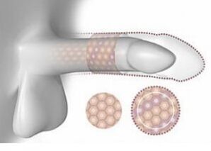 Zvýšený objem penisu